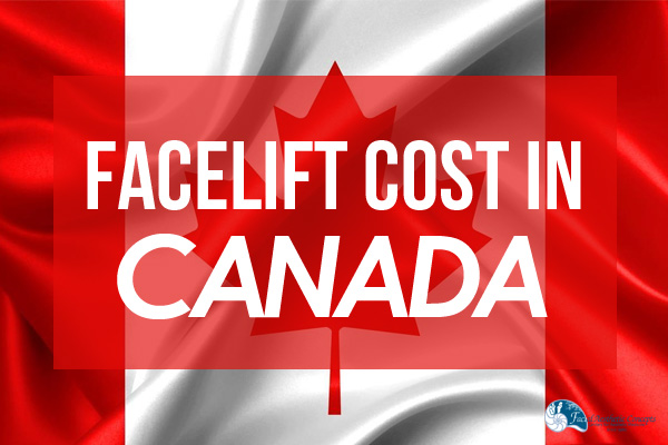 Facelift Cost Canada