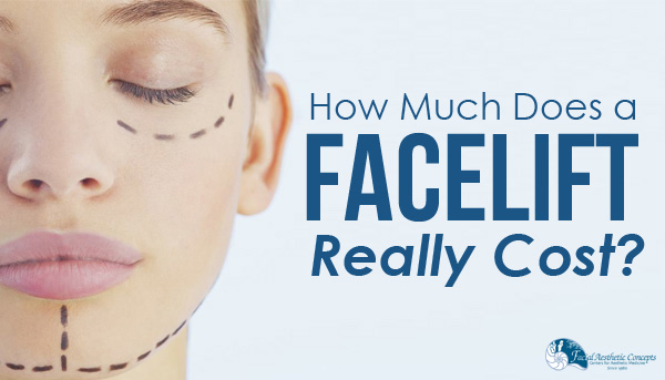 How much does a facelift really cost