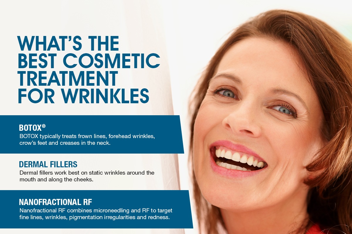 What's The Best Cosmetic Treatment For Wrinkles [Infographic]