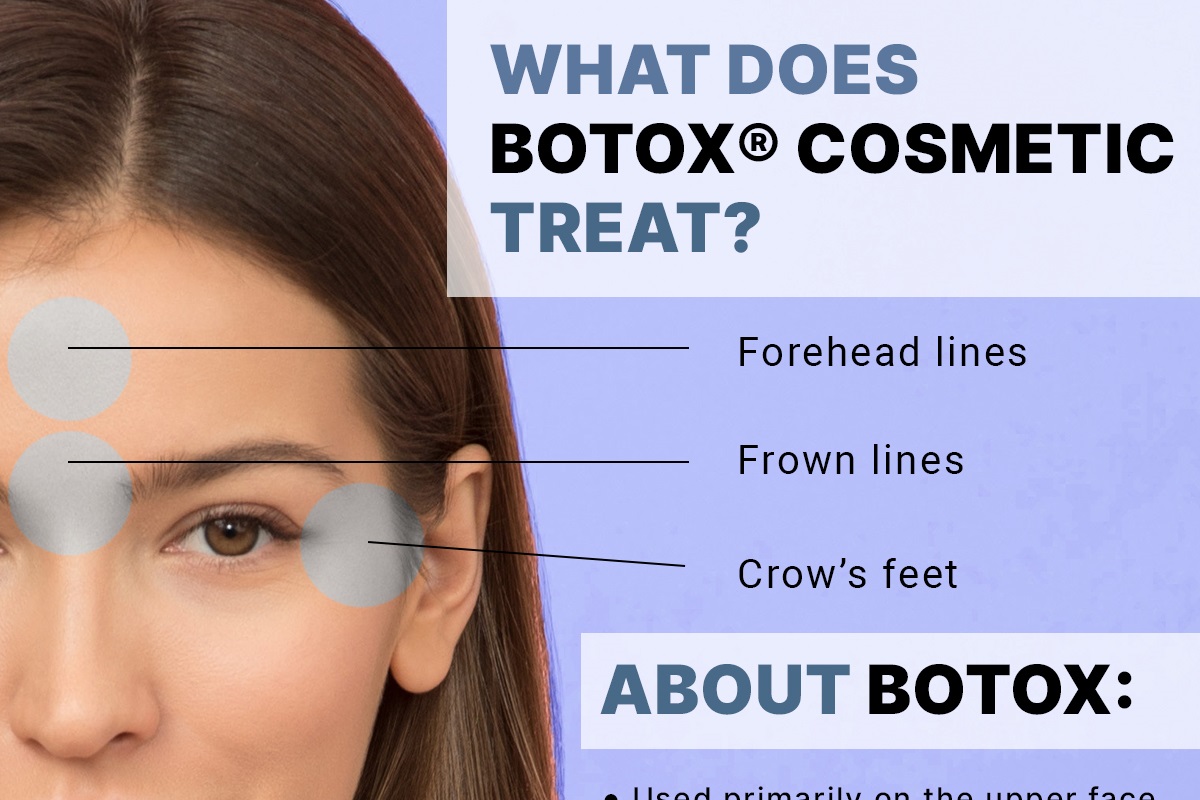 What Does Botox® Cosmetic Treat? [Infographic]
