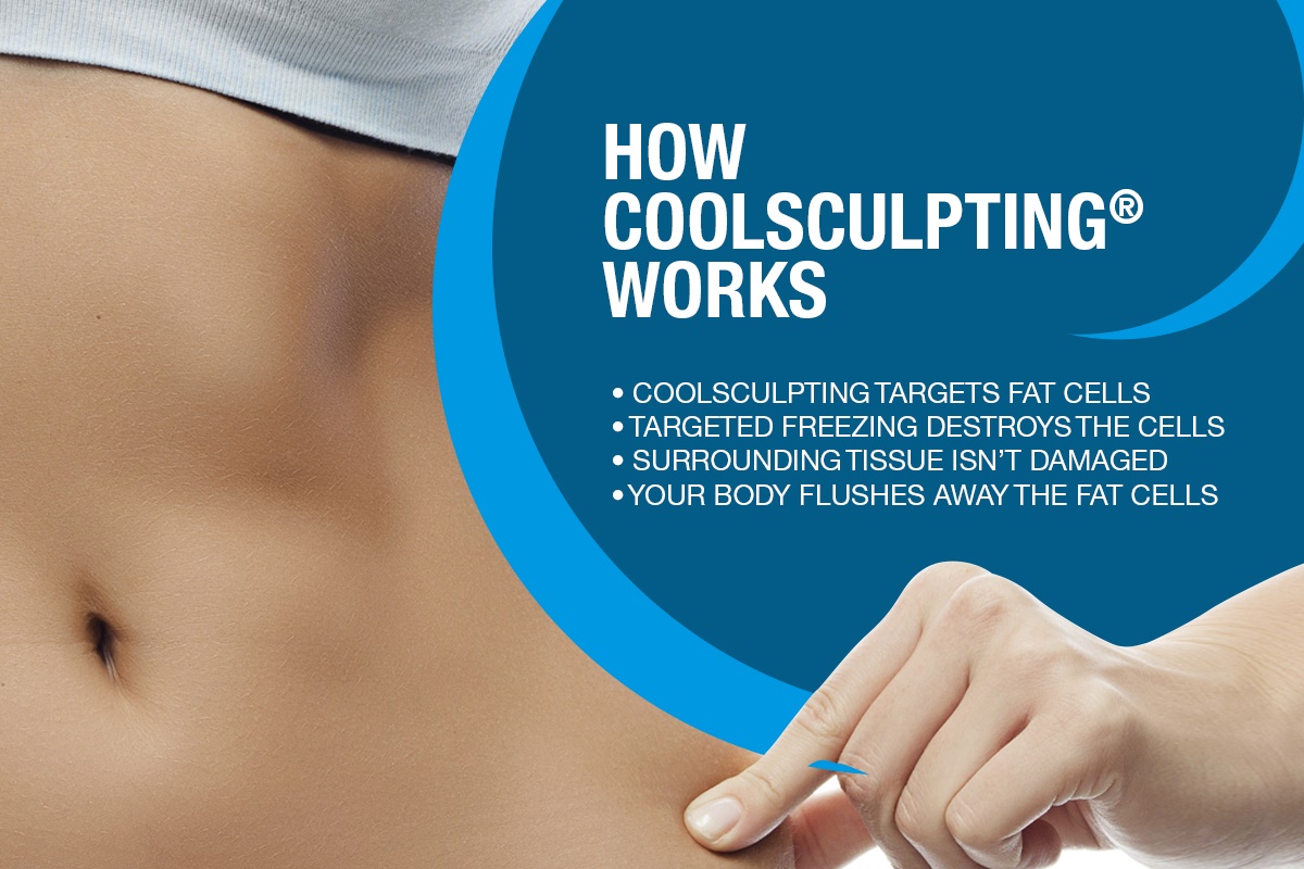 How Coolsculpting® Works [Infographic]