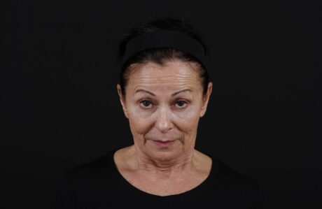 Fillers case #4320