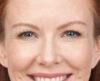 BOTOX® case #3599