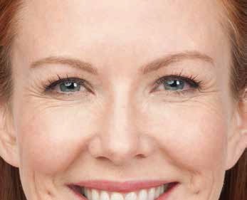 BOTOX® case #3599