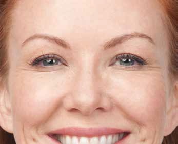 BOTOX® case #3599