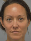 Eyelid Surgery case #11802