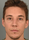 Rhinoplasty case #11713