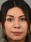Rhinoplasty case #11706