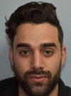 Rhinoplasty case #11704