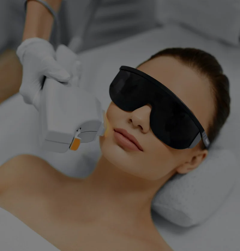 skin-laser-v2